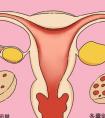多囊卵巢患者有几种怀孕方法?只能做试管了吗?