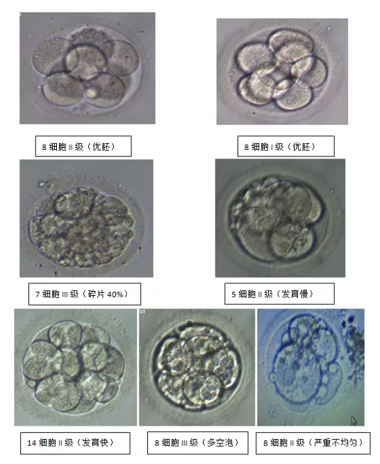 什么样的胚胎才是好胚胎？