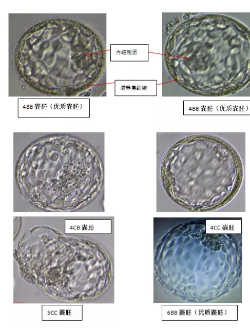 什么样的胚胎才是好胚胎？