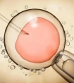 做试管婴儿在胚胎移植时会令人很痛吗?