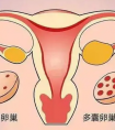 以为取卵数越多越好?小心卵巢过度刺激综合征!