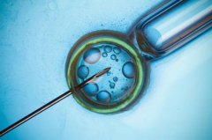 试管｜胚胎第3天筛查和第5天筛查的差别