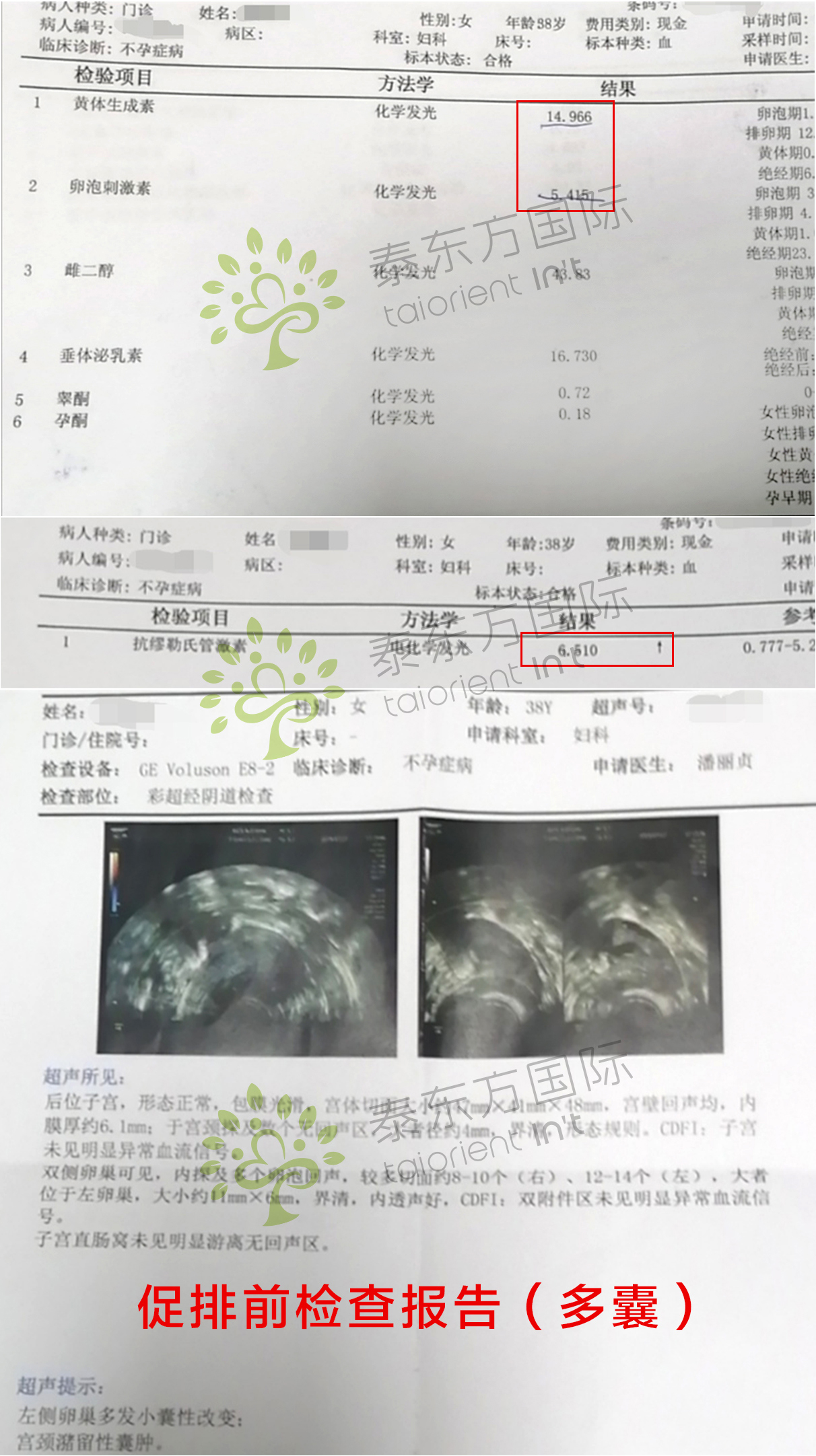 怀孕6个多月B超发现胎儿下腹部有囊肿（非常着急在线等） - 百度宝宝知道