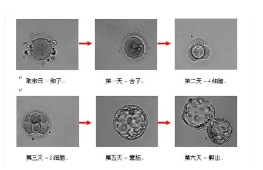 泰国试管移植鲜胚和囊胚 哪个双胎妊娠的几率更高呢?