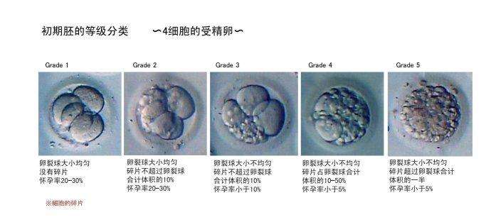 试管婴儿囊胚等级划分你知道多少内容?