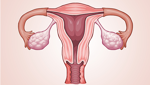 为什么试管婴儿移植前调理子宫内膜?